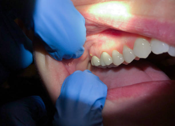 Best Emergency Dental Care for Trauma or Injury in Marietta Alderwood, WA