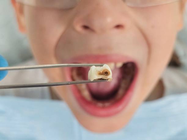 Best Emergency Orthodontic Repairs in Marietta Alderwood, WA